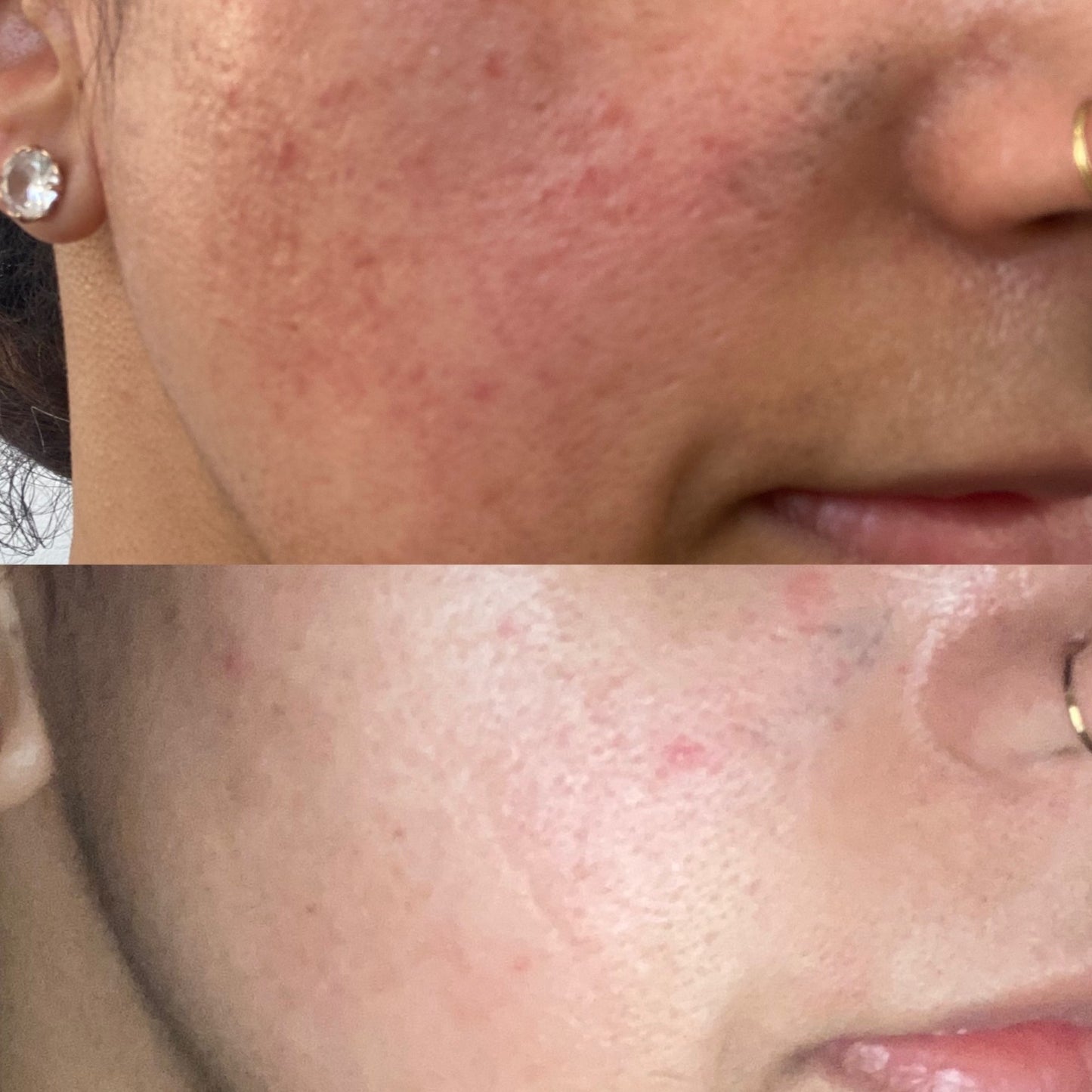 Skin Renewal and Repair Balm For Glowing Skin