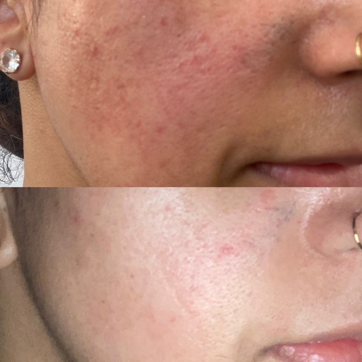 Before and after results